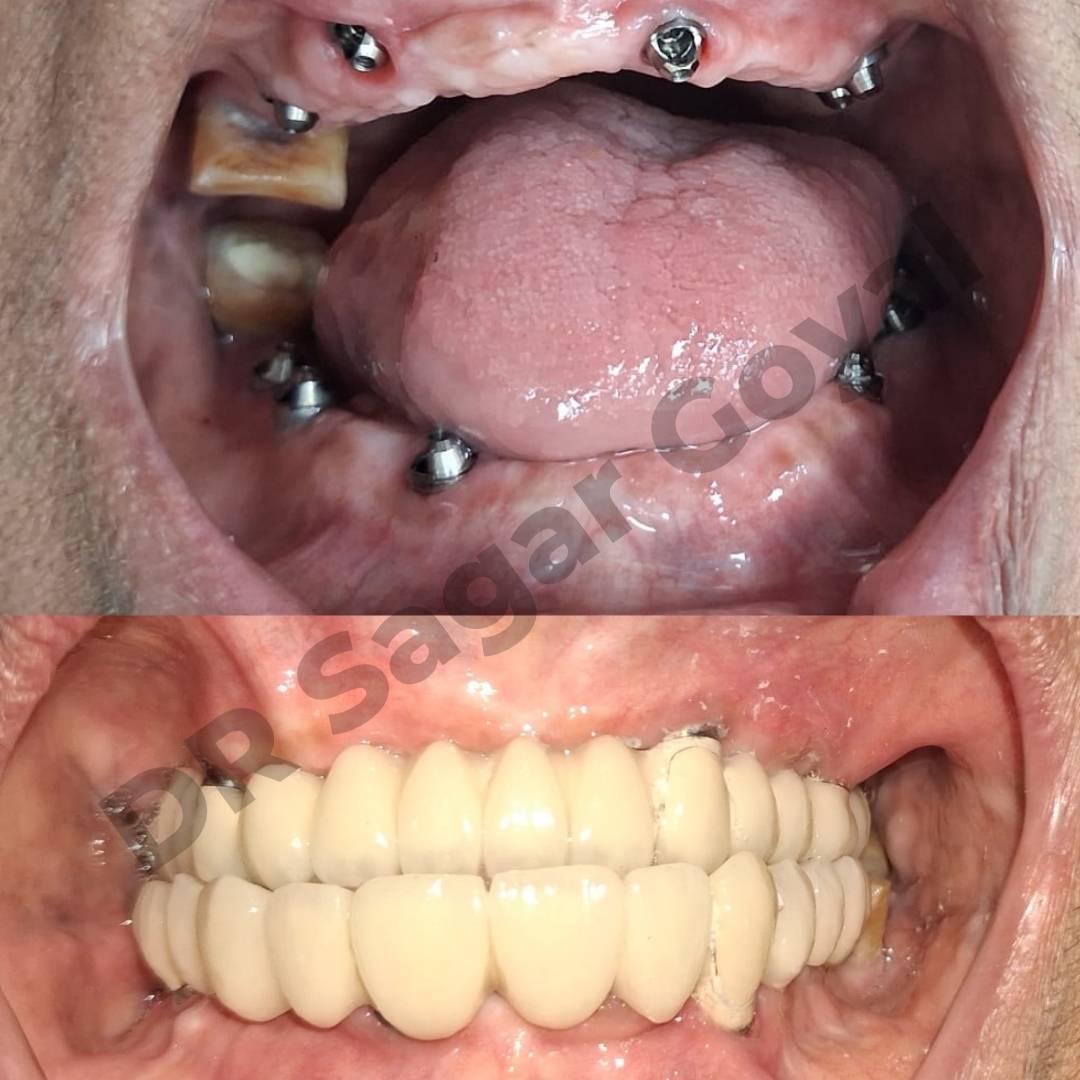 Full mouth rehabilitation treatment room – Goyal Dental Hospital Kaithal