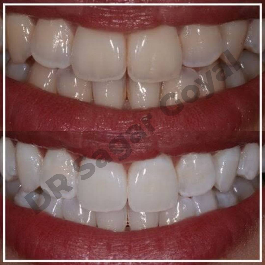 Professional teeth whitening treatment room – best teeth whitening service in Kaithal